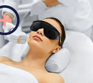 Hair Removal, Laser & IPL